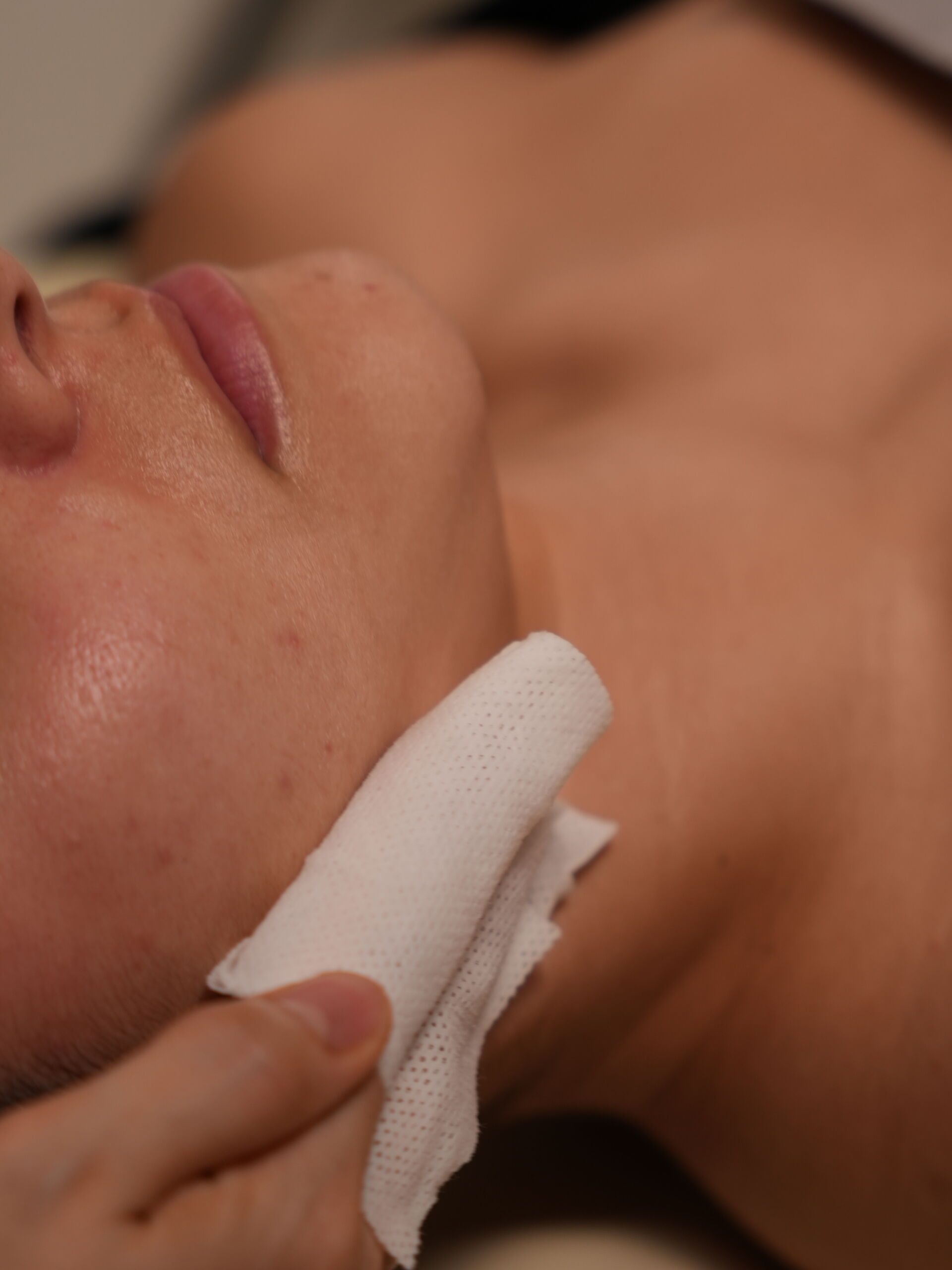 Blemish Control Program